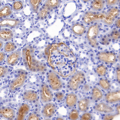 Pklr Recombinant Rabbit mAb (S-4114-40)