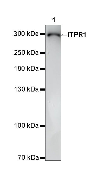 ITPR1 Recombinant Rabbit mAb (S-4530-47)