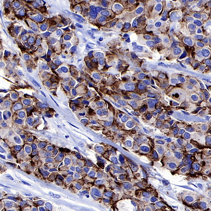 S-RMab® MUC1/EMA Recombinant Rabbit mAb (SDT-776-49)