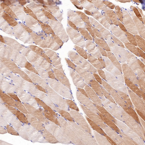 Alpha B Crystallin Recombinant Rabbit mAb (S-R216)