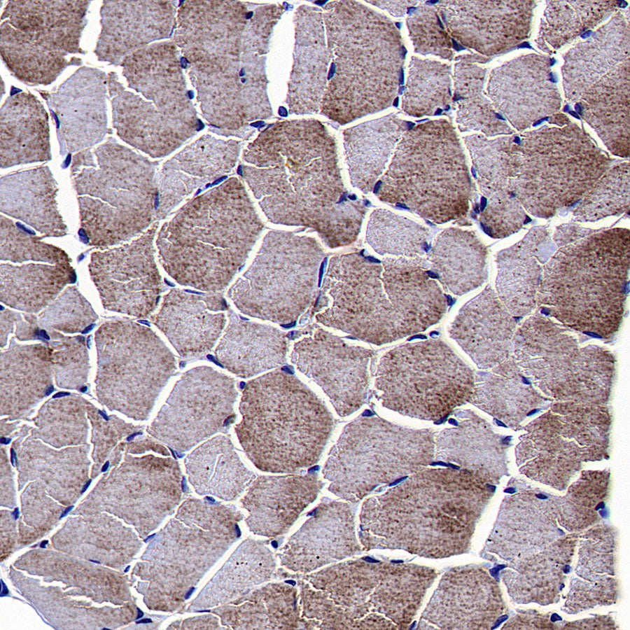 WWP1 Recombinant Rabbit mAb (S-4412-25)