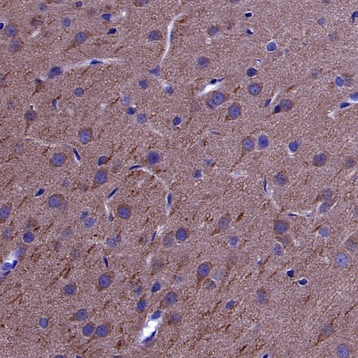 PSD-95 Recombinant Rabbit mAb (S-1518-4)