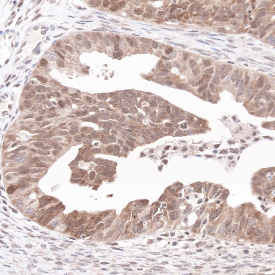 p53 Recombinant Rabbit mAb (SDT-100-72)