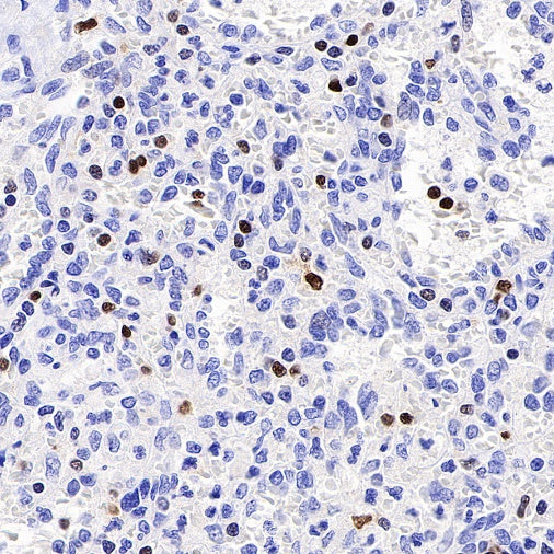 T-bet/TBX21 Recombinant Rabbit mAb (S-583-54)