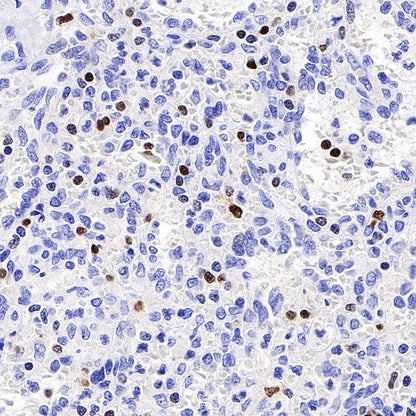 T-bet/TBX21 Recombinant Rabbit mAb (S-583-54)