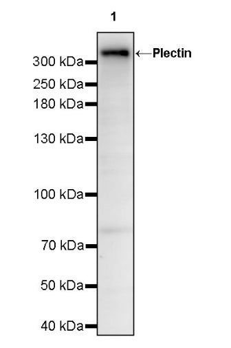 Plectin Recombinant Rabbit mAb (S-721-326)