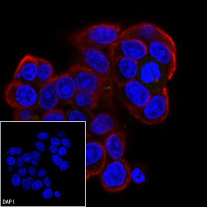 Phospho-ULK1 (Ser757) Recombinant Rabbit mAb (S-3495)