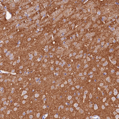 α/β-Synuclein Recombinant Rabbit mAb (S-309-72)