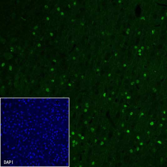 Olig2 Recombinant Rabbit mAb,PBS Only (SDT-648-155)