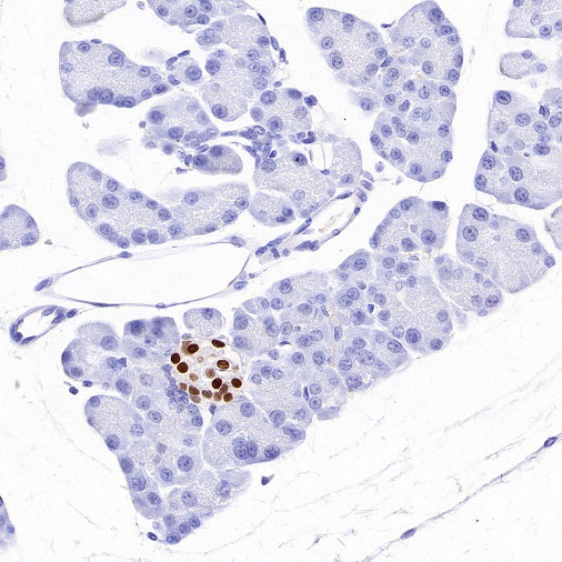 INSM1 Recombinant Rabbit mAb (SDT-3165-72)