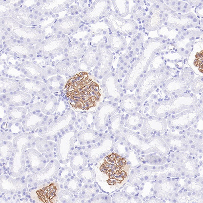 Synaptopodin Recombinant Rabbit mAb (SDT-3331-4)