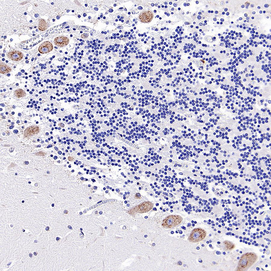 CCDC47 Recombinant Rabbit mAb (S-4158-17)