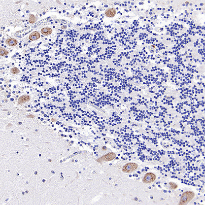 CCDC47 Recombinant Rabbit mAb (S-4158-17)