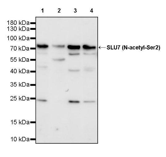 SLU7 (N-acetyl-Ser2) Recombinant Rabbit mAb (S-3662-17)