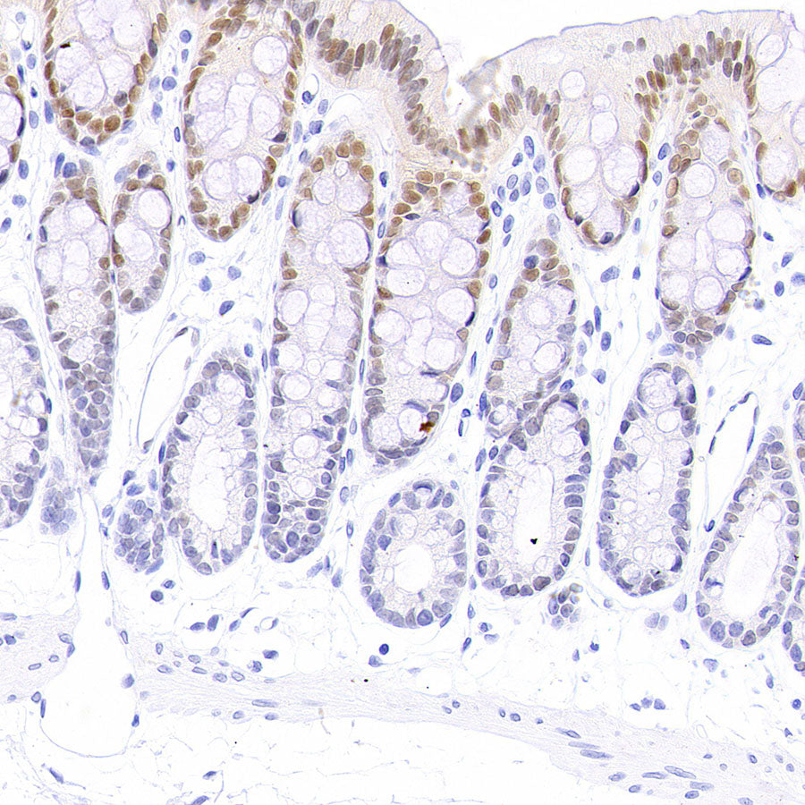 PAPSS1 Recombinant Rabbit mAb (S-3516-23)
