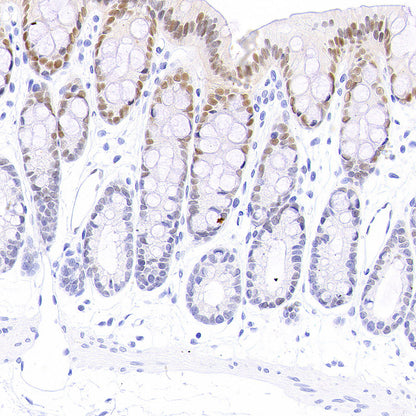PAPSS1 Recombinant Rabbit mAb (S-3516-23)