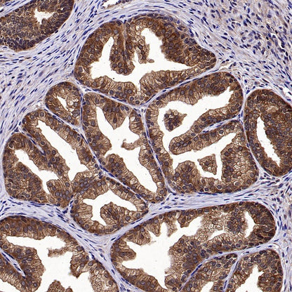 Phospho-eIF4E (Ser209) Recombinant Rabbit mAb (S-2652-195)