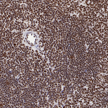 NPM1 Rabbit Polyclonal Antibody