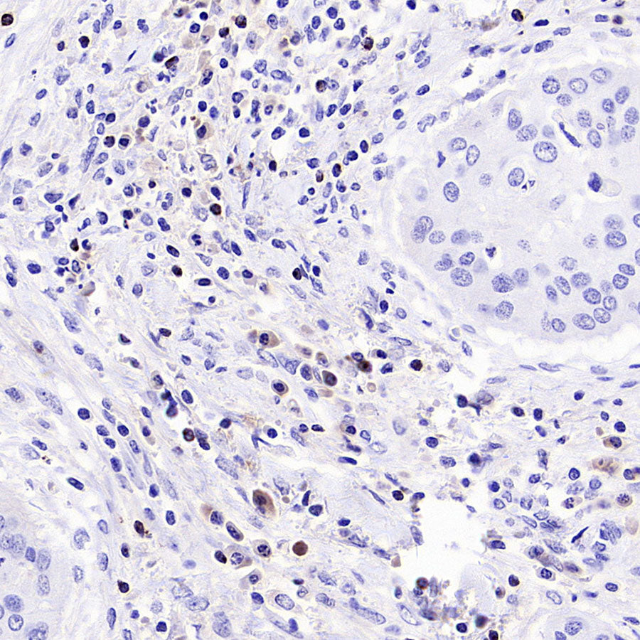 CCL18 Recombinant Rabbit mAb (S-2788-25)