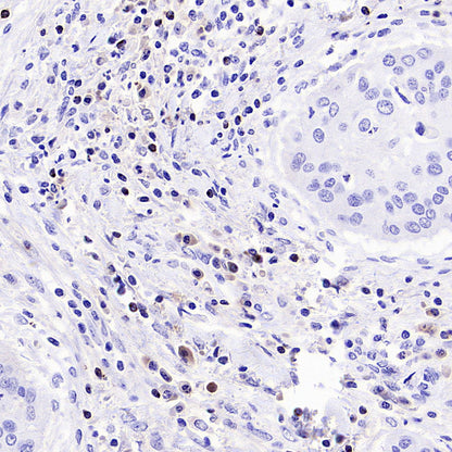 CCL18 Recombinant Rabbit mAb (S-2788-25)
