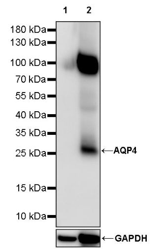 AQP4 Recombinant Rabbit mAb (S-1609-62)