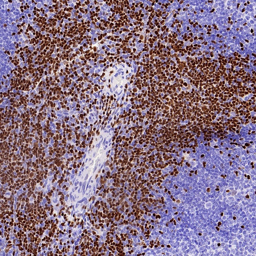 TCF1/TCF7 Recombinant Rabbit mAb (S-3486)