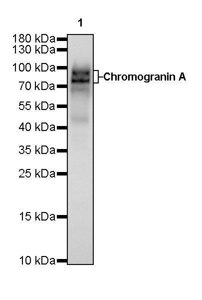 S-RMab® Chromogranin A Recombinant Rabbit mAb (SDT-074-57)