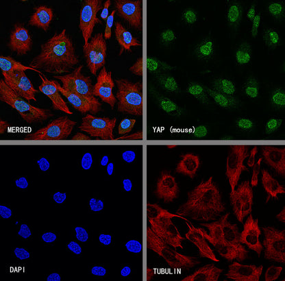 YAP Recombinant Rabbit mAb (S-3921-42)