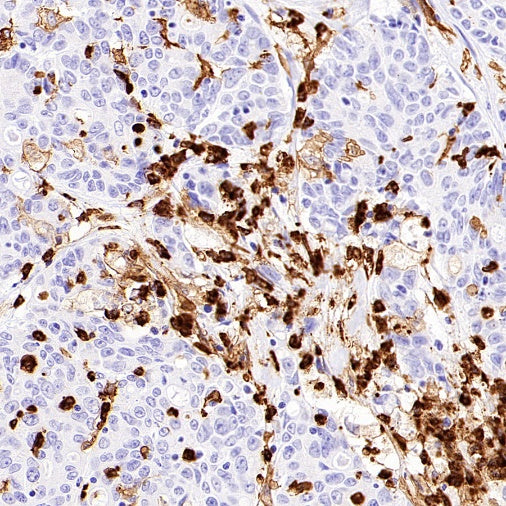 NOX2/gp91phox Recombinant Rabbit mAb (S-2974-75)