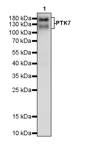 PTK7 Recombinant Rabbit mAb (SDT-2432-156)