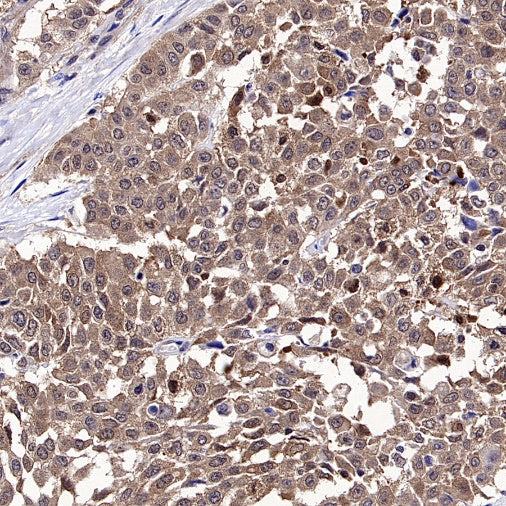 PPIA Recombinant Rabbit mAb (S-2406-28)