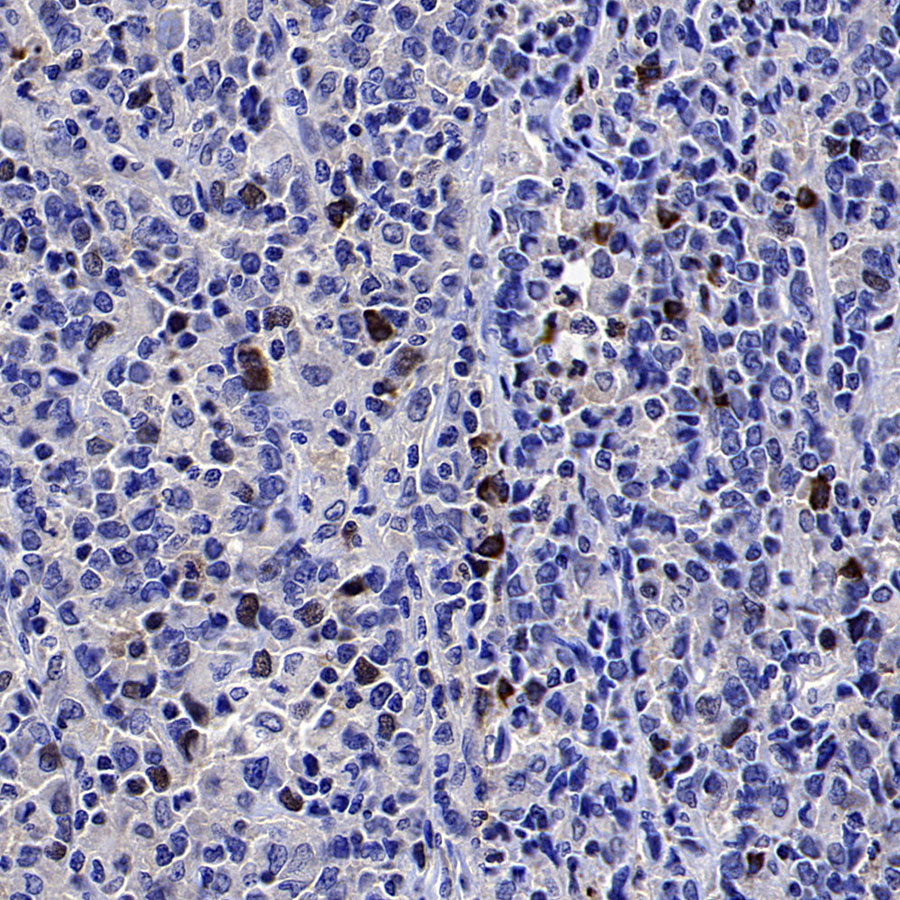 CENP-F Recombinant Rabbit mAb (S-3148-75)