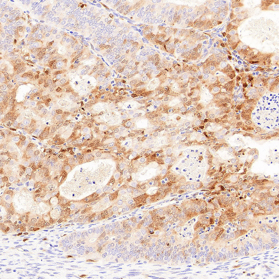 Galectin-9 Recombinant Rabbit mAb (S-4579-67)