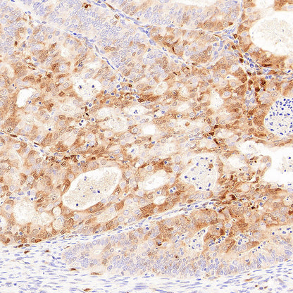 Galectin-9 Recombinant Rabbit mAb (S-4579-67)