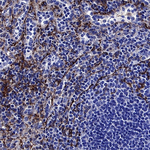 Phospho-Vimentin (Ser39) Rabbit Polyclonal Antibody