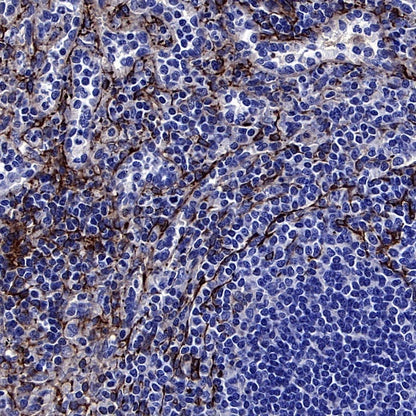 Phospho-Vimentin (Ser39) Rabbit Polyclonal Antibody