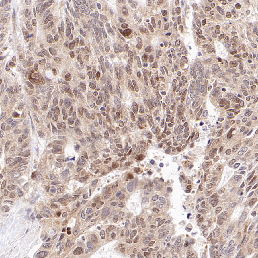 PDIA3 Rabbit Polyclonal Antibody