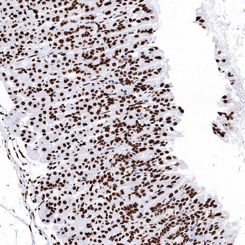 Histone H3 (mono methyl K36) Recombinant Rabbit mAb (S-R396)
