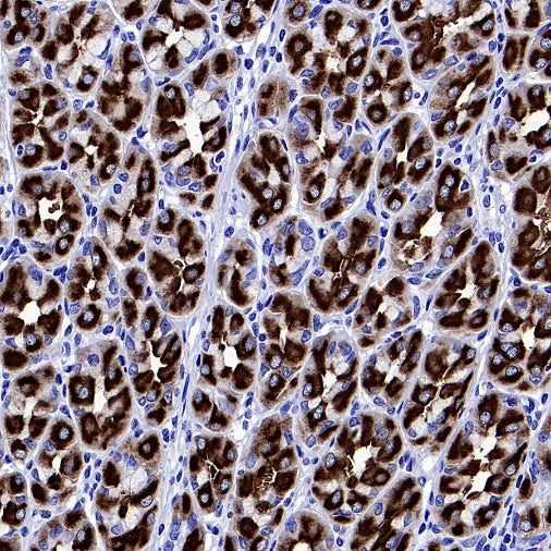 ATP4B Recombinant Rabbit mAb (SDT-2445-64)