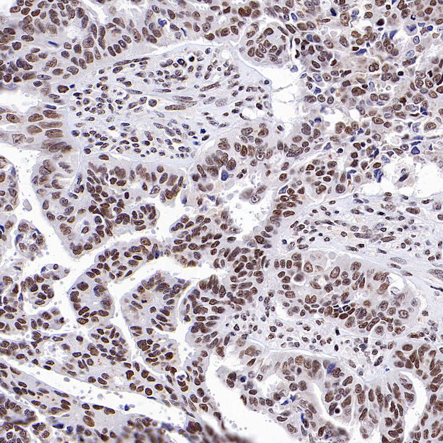 RFX5 Recombinant Rabbit mAb (S-3628-50)