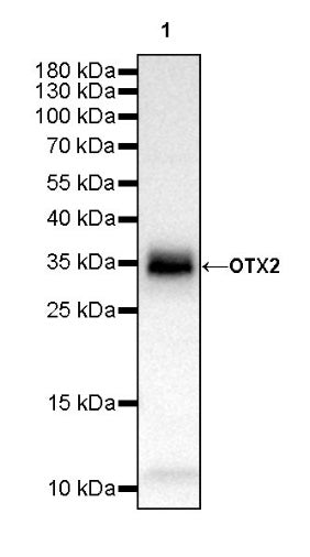 OTX2 Recombinant Rabbit mAb (S-2095-8)