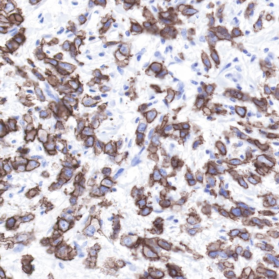 ErbB2 Recombinant Rabbit mAb (SDT-069-10)
