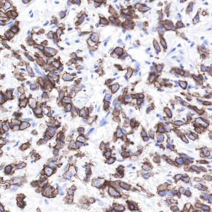 ErbB2 Recombinant Rabbit mAb (SDT-069-10)