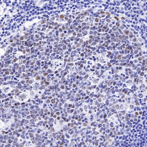 S-RMab®Topoisomerase I Recombinant Rabbit mAb (S-R209)
