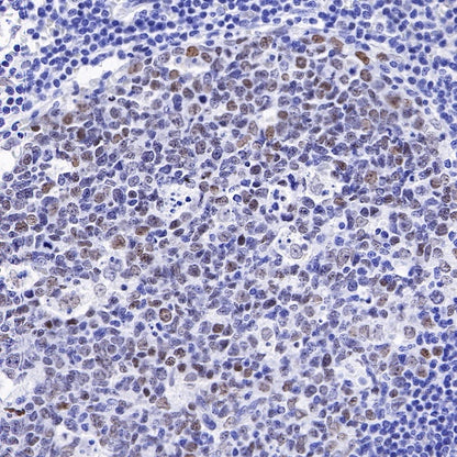 S-RMab®Topoisomerase I Recombinant Rabbit mAb (S-R209)