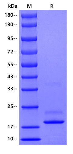 Mouse TNF-alpha Protein, His tag