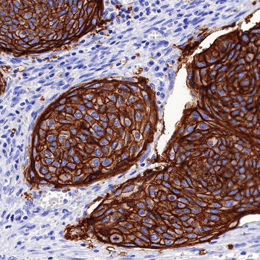 TACSTD2/TROP2 Recombinant Rabbit mAb (S-R238)