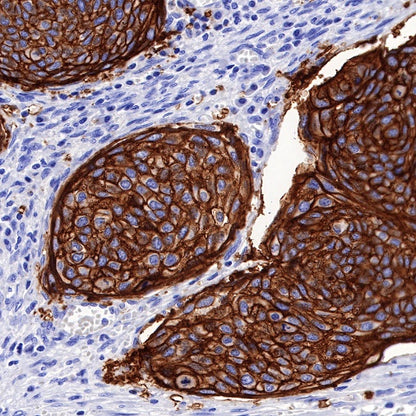 TACSTD2/TROP2 Recombinant Rabbit mAb (S-R238)