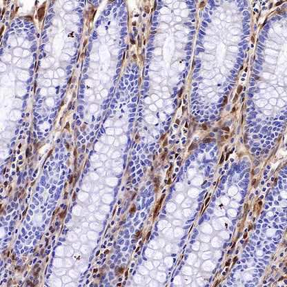 NNMT Recombinant Rabbit mAb (S-3470-58)