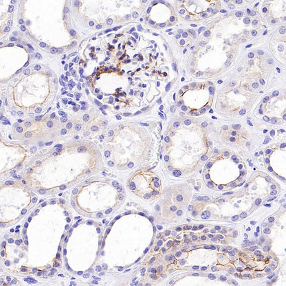 B7-H6 Recombinant Rabbit mAb (SDT-3241-6)